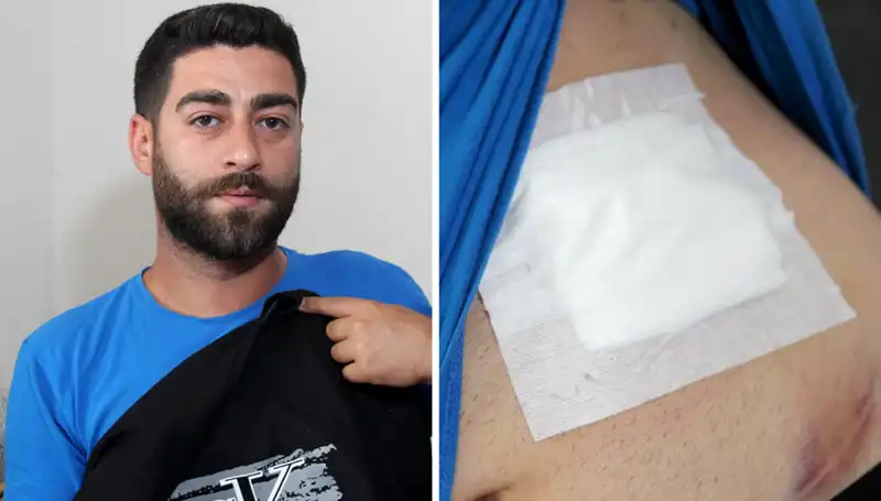 Karnında Ağrı Hissetti, Röntgen Sonucu Şok Etti!