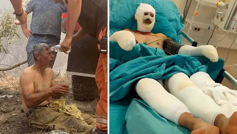 Yanıyorum Diye Feryat Eden Orman İşçisinin Hayatta Kalma Mücadelesi