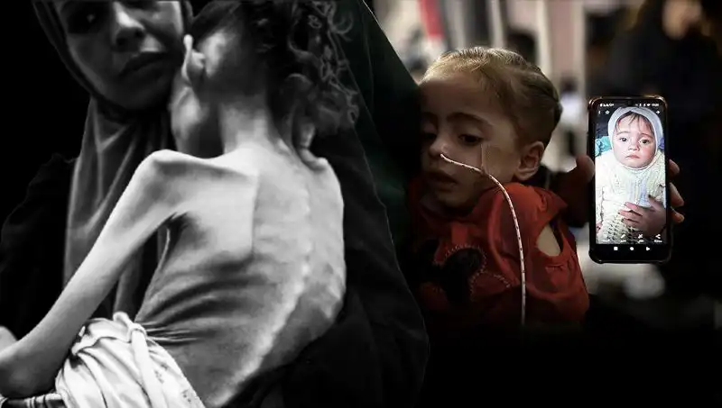 Küçük Meryem’in Açlık Mücadelesi: 25 Kilodan 10 Kiloya Düşüşü