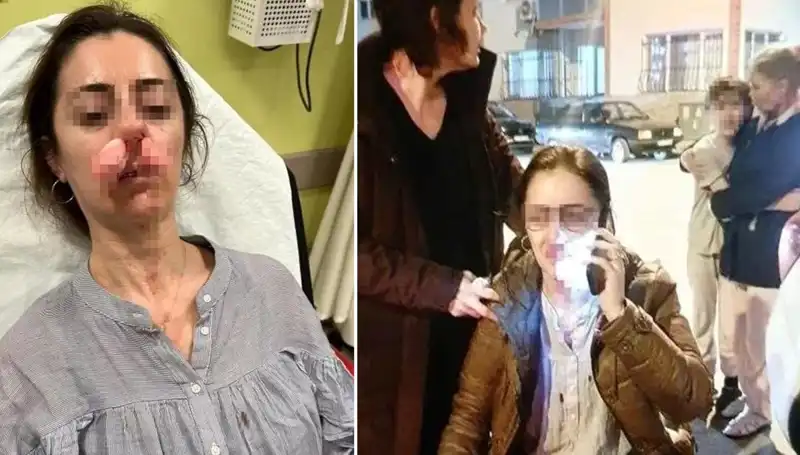 Eşinin Sevgilisini Yanlışlıkla Otomobil Kapısıyla Saldırdı, Olay Şoke Etti!