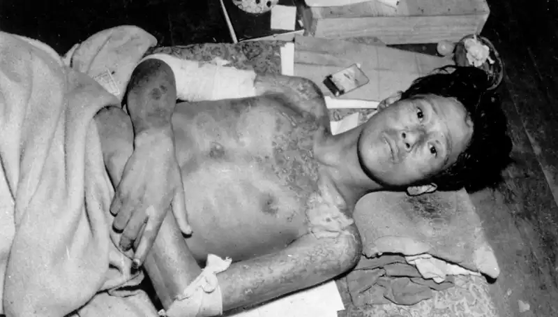 80 Yıl Sonra Nagasaki’den Gelen Korkutucu Çağrı: Nükleer Tehdit Yeniden Gündemde!