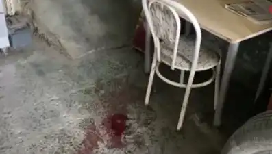 Sandalyeden Düşmek Korkunç Bir Kazaya Neden Oldu!